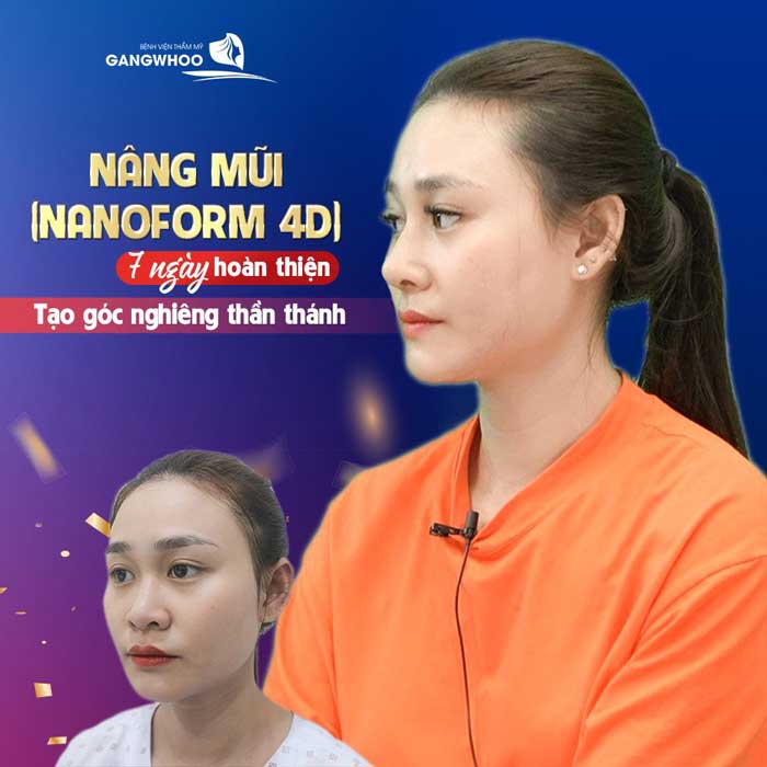 Nâng Mũi Ở Đâu Đẹp Tại Kiên Giang? Địa Chỉ Uy Tín Không Thể Bỏ Lỡ