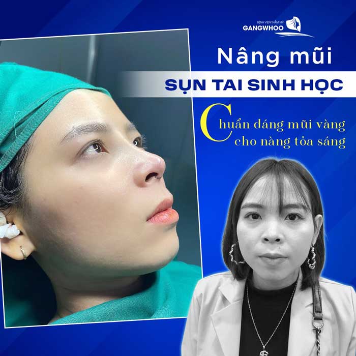 Nâng Mũi Ở Đâu Đẹp Tại Vũng Tàu?