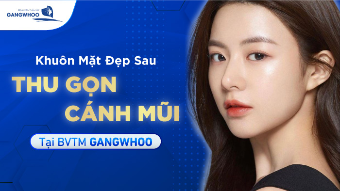 Khuôn Mặt Đẹp Sau Thu Gọn Cánh Mũi Tại BVTM Gangwhoo