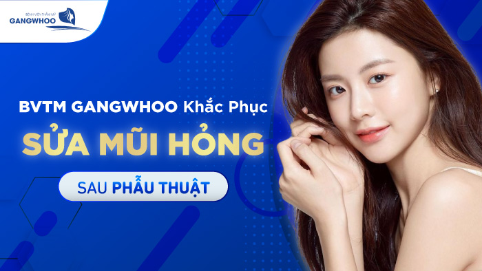 BVTM Gangwhoo Khắc Phục Sửa Mũi Hỏng Sau Phẫu Thuật