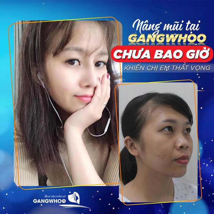 Tại Sao Nên Chọn BVTM Gangwhoo để làm đẹp?