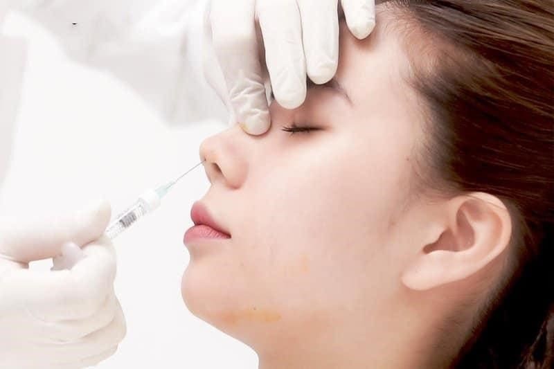 Thực hiện tiêm filler nâng mũi được giới trẻ lựa chọn nhiều hiện nay