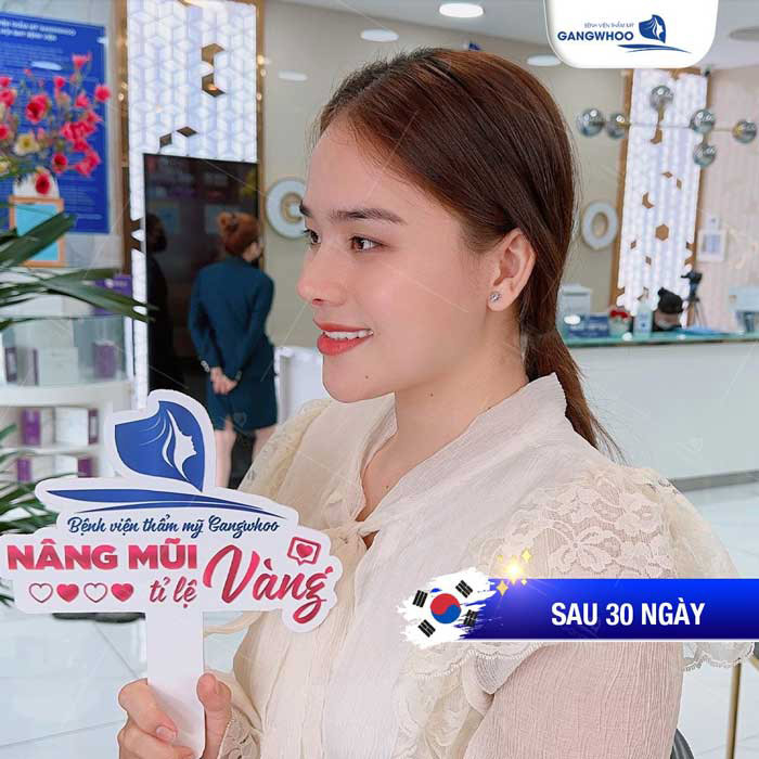 Bị cảm có nâng mũi được không - Sở hữu dáng mũi đẹp tự nhiên của “Thánh Sún” Ngân Thảo sau khi thực hiện nâng mũi cấu trúc