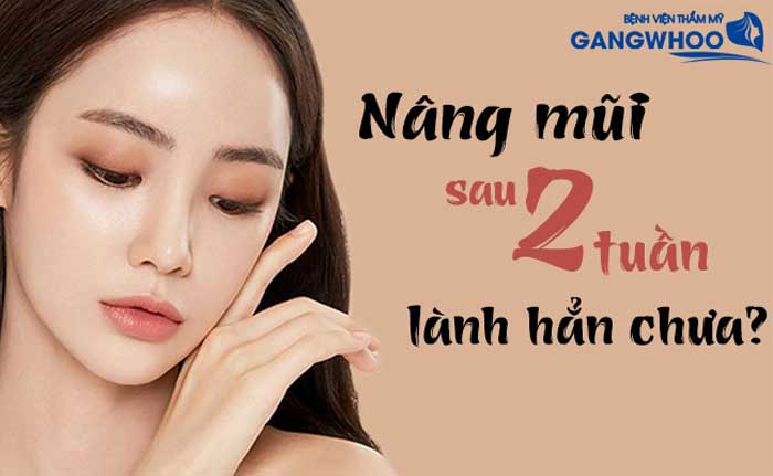 Sau 2 Tuần Nâng Mũi Sẽ Thế Nào?