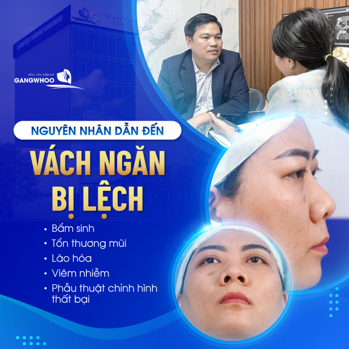 Chỉnh hình vách ngăn