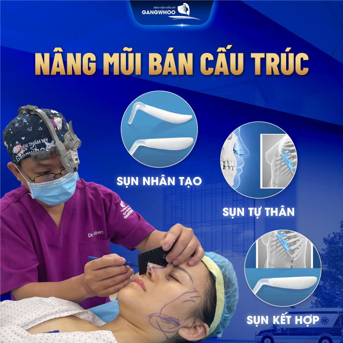 Nâng mũi bán cấu trúc