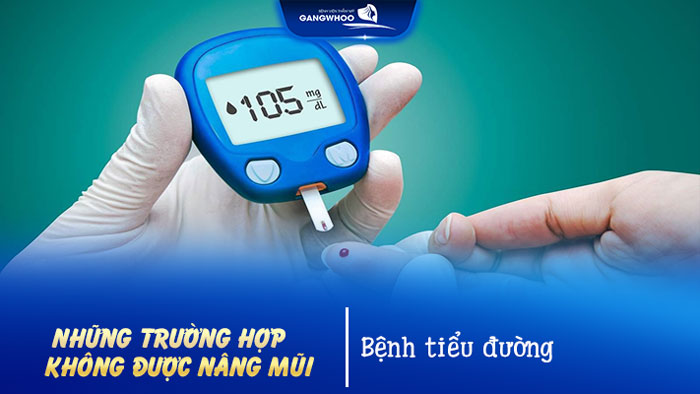 Những trường hợp không được nâng mũi