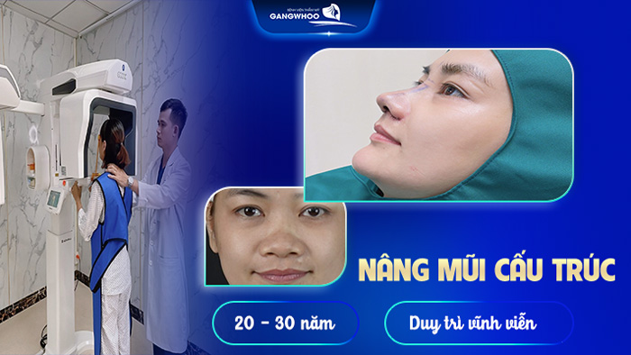 Nâng mũi có để được cả đời không