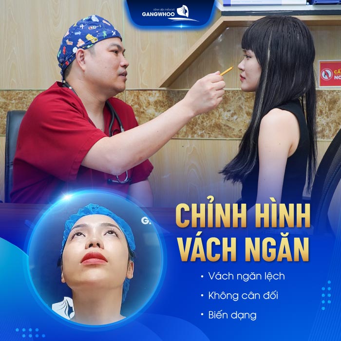 Chỉnh hình vách ngăn