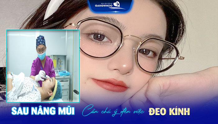 Nâng Mũi Bao Lâu Được Trang Điểm