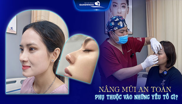 Nâng Mũi Có Hại Về Sau Không