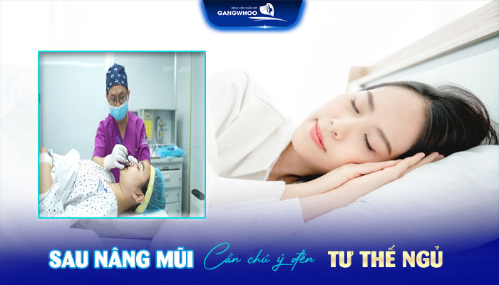 Nâng Mũi Bao Lâu Được Trang Điểm