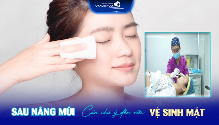 Nâng Mũi Bao Lâu Được Trang Điểm