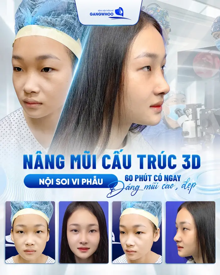 Review 12 Địa Chỉ Nâng Mũi Ở TPHCM Điểm Đến Top Đầu Về Chất Lượng