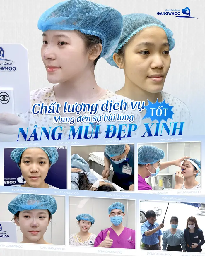 Review 5 Địa Chỉ Nâng Mũi Ở Bắc Ninh Top Đầu Về Chất Lượng