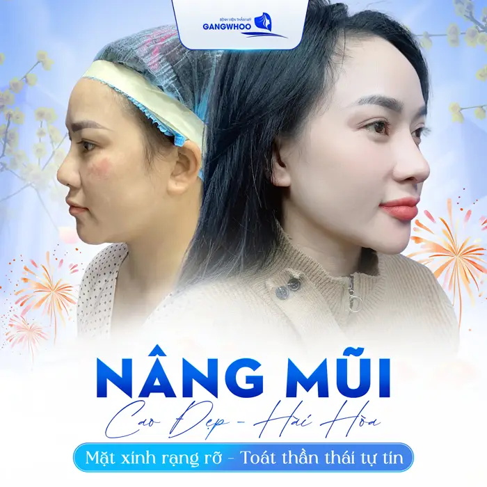 Review 3 Địa Chỉ Nâng Mũi Ở Trà Vinh Được Khách Hàng Bình Chọn