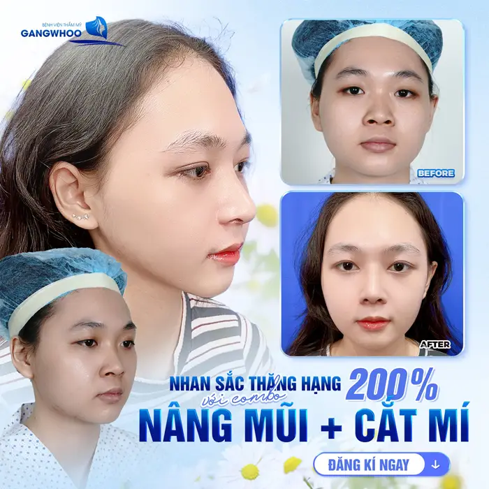 Đừng Vội Nâng Mũi Ở Kon Tum Nếu Chưa Biết 5 Cơ Sở Này