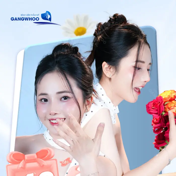 Kết quả nâng mũi Hàn Quốc cho dáng mũi thanh thoát, hài hòa