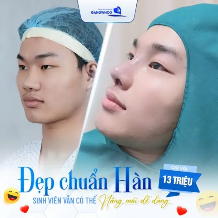 Nâng mũi Hàn Quốc mang lại đường sống mũi cao tự nhiên